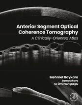 Anterior Segment Optical Coherence Tomography