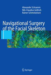 Navigational Surgery of the Facial Skeleton