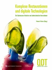 Komplexe Restaurationen und digitale Technologien