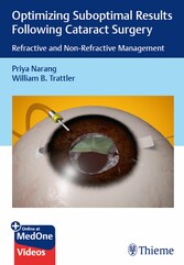 Optimizing Suboptimal Results Following Cataract Surgery