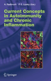 Current Concepts in Autoimmunity and Chronic Inflammation