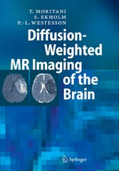 Diffusion-Weighted MR Imaging of the Brain