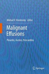 Malignant Effusions