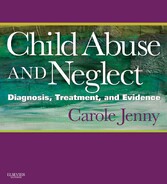 Child Abuse and Neglect E-Book