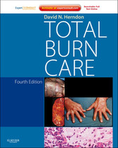 Total Burn Care