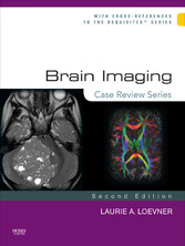 Brain Imaging