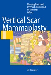 Vertical Scar Mammaplasty