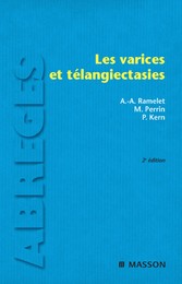 Les varices et télangiectasies