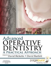 Advanced Operative Dentistry