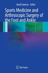 Sports Medicine and Arthroscopic Surgery of the Foot and Ankle