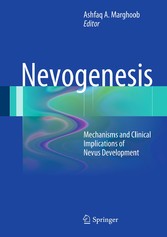 Nevogenesis