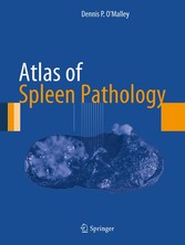 Atlas of Spleen Pathology