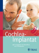 Cochlea-Implantat