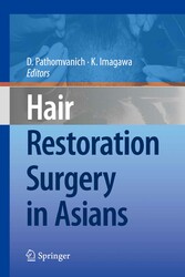 Hair Restoration Surgery in Asians