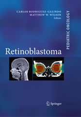 Retinoblastoma