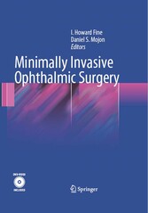 Minimally Invasive Ophthalmic Surgery