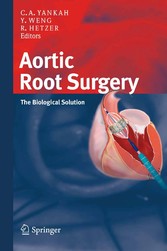 Aortic Root Surgery