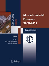 Musculoskeletal Diseases 2009-2012