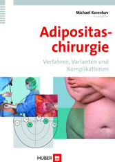 Adipositaschirurgie