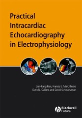 Practical Intracardiac Echocardiography in Electrophysiology