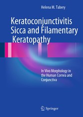 Keratoconjunctivitis Sicca and Filamentary Keratopathy