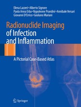 Radionuclide Imaging of Infection and Inflammation