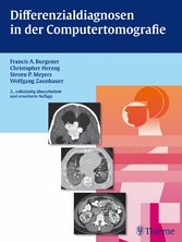 Differenzialdiagnosen in der Computertomografie