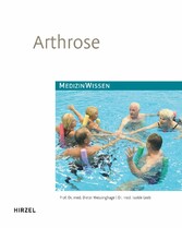 Arthrose