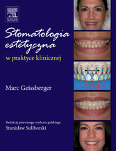 Stomatologia estetyczna w praktyce klinicznej