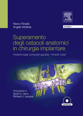 SUPERAMENTO DEGLI OSTACOLI ANATOMICI IN CHIURGIA IMPLANTARE