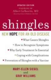 Shingles