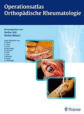 Operationsatlas Orthopädische Rheumatologie