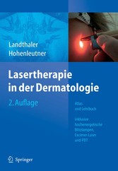 Lasertherapie in der Dermatologie